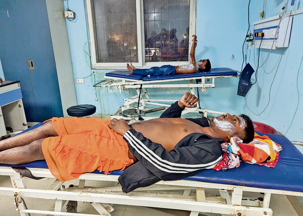 Ara News : तिलक समारोह में कॉफी मशीन ब्लास्ट करने से छह घायल, दो की हालत गंभीर