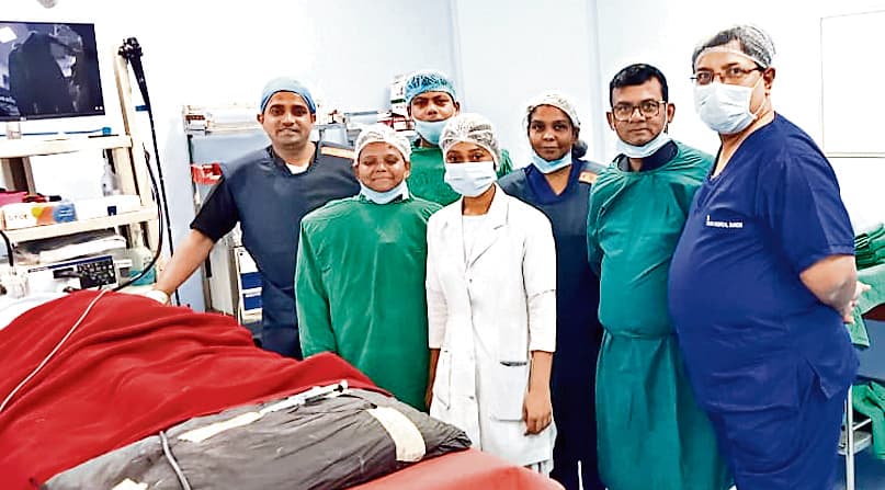 Ranchi news : सदर अस्पताल में नयी तकनीक से पित्त की थैली से निकाला गया स्टोन