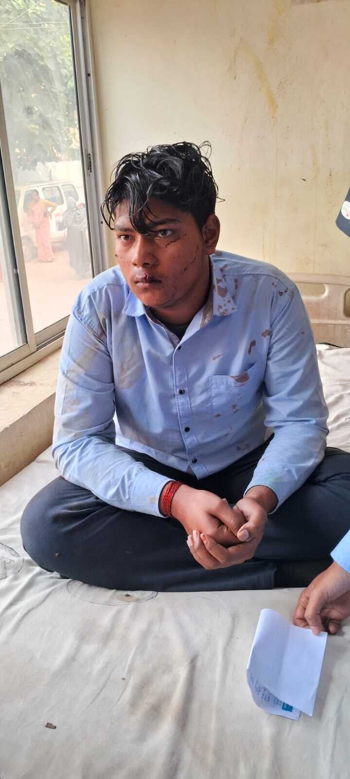 दो बाइक के आमने-सामने की टक्कर में 3 घायल