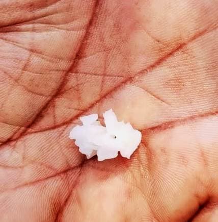 Bhagalpur news एमडीएम में निकला कीड़ा, आक्रोशित ग्रामीणों ने भोजन लौटाया