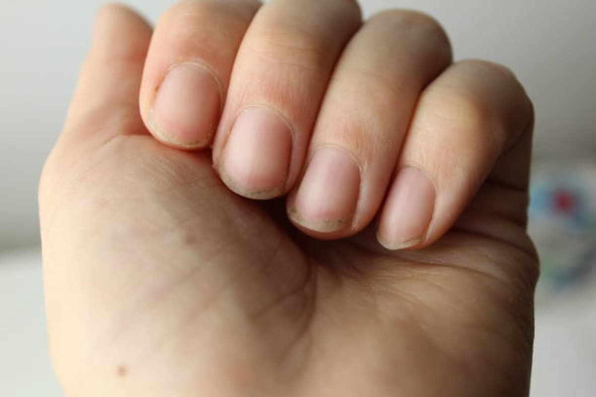 how to remove yellow stains form nail how to remove yellow stains form nail