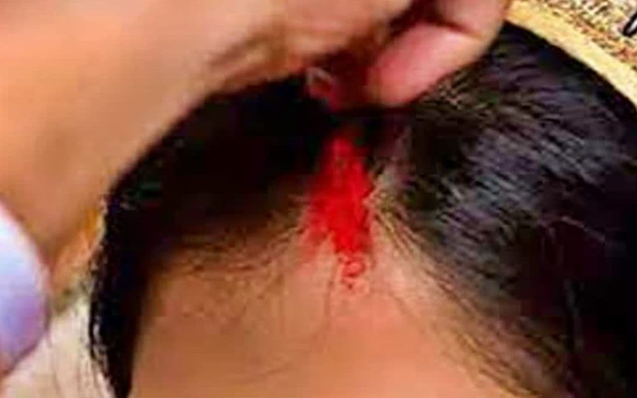 Bihar News: बांका में नाबालिग लड़की की मांग में डाला सिंदूर, विरोध करने जमकर पीटा