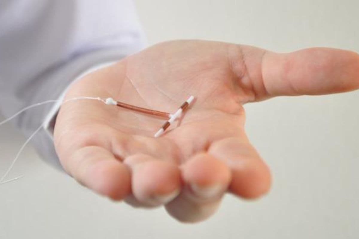 West Bengal : अब अनचाही प्रेगनेंसी से 3 साल तक छुटकारा, 'इम्प्लांट' रोकेगा गर्भधारण