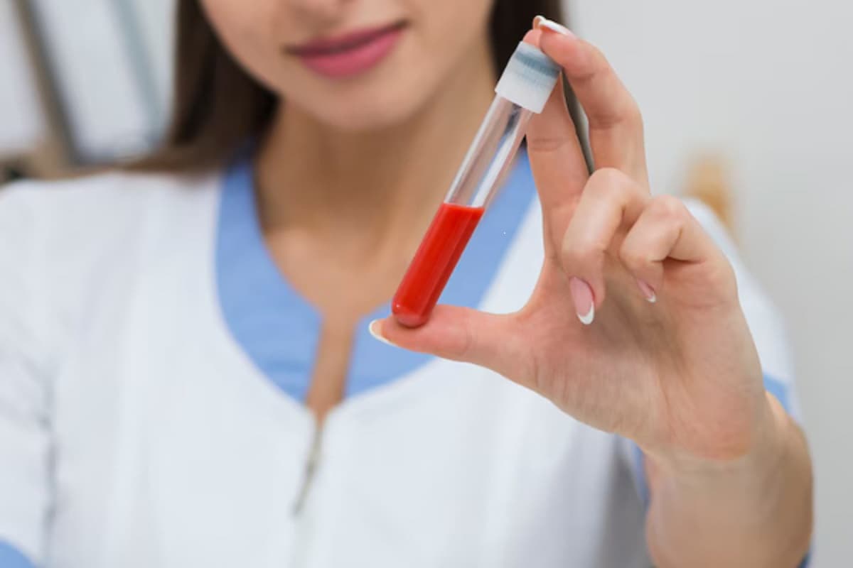 Rarest Blood Group: सोने से भी बढ़कर है यह ब्लड ग्रुप, दुनिया में मिला सिर्फ 45 लोगों में, जानें खूबी