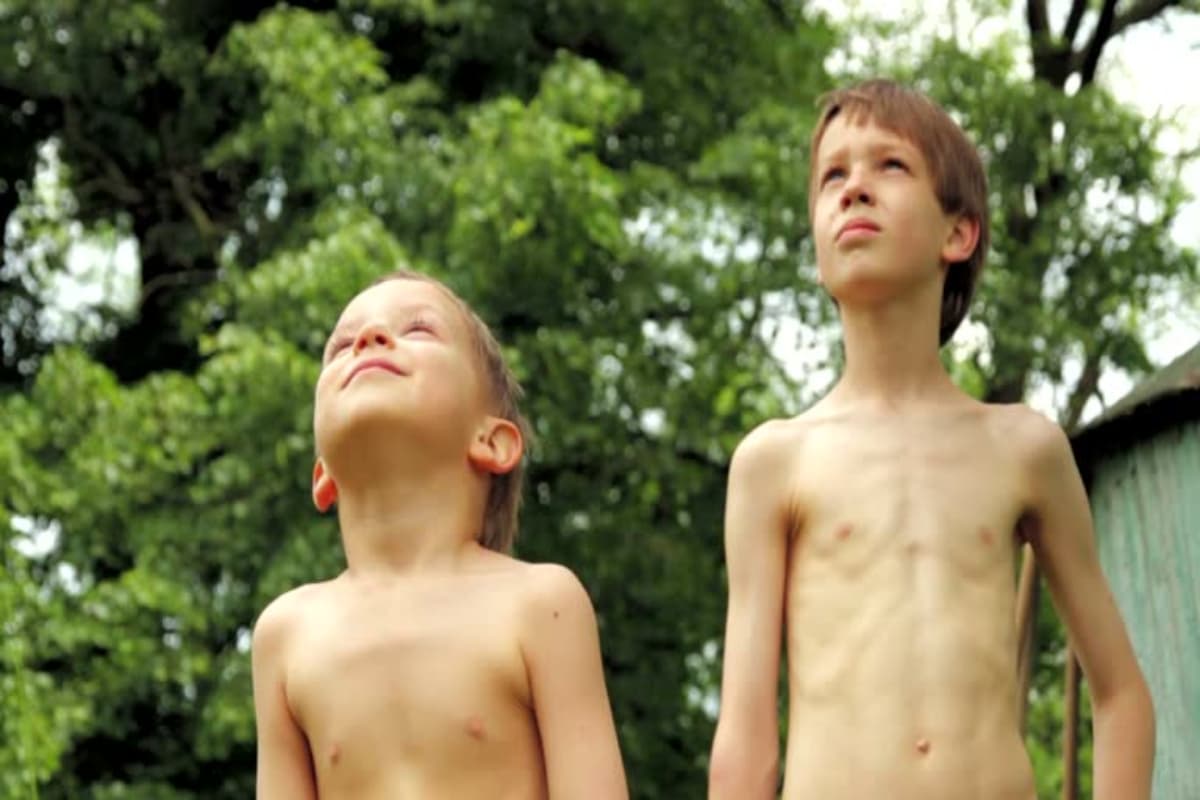 Underweight Children