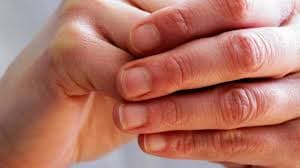 Winter Care Tips: सर्दी के कारण उंगलियां हो रही है लाल, और होती है खुजली, फॉलो करें ये 5 टिप्स