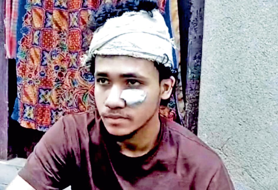 बेलघरिया : दोस्त से मिलने ढाका गये युवक को बांग्लादेशियों ने पीटा