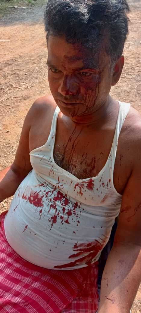 जमीन विवाद में पड़ोसी ने युवक पर किया जानलेवा हमला, भर्ती