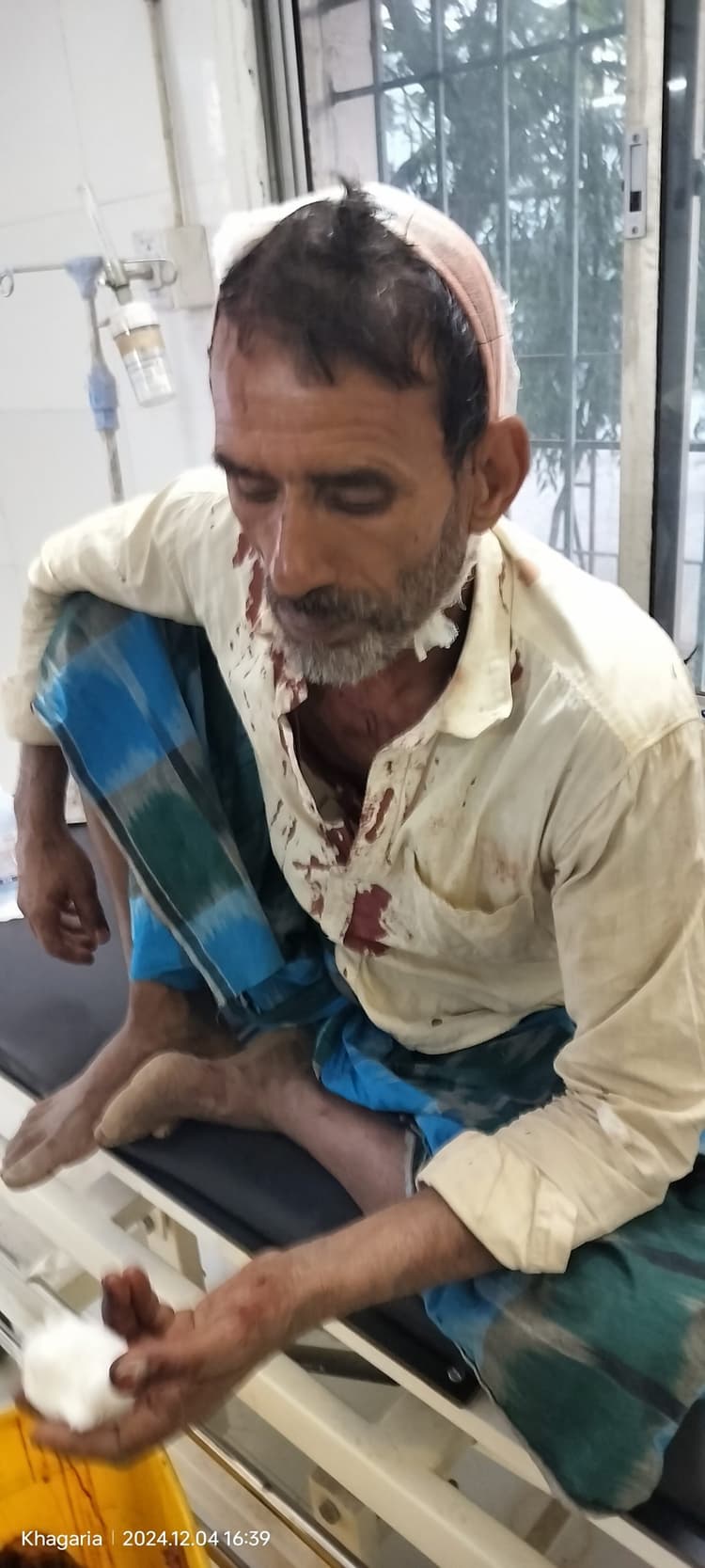 भूमि विवाद में मारपीट, आधा दर्जन से अधिक घायल