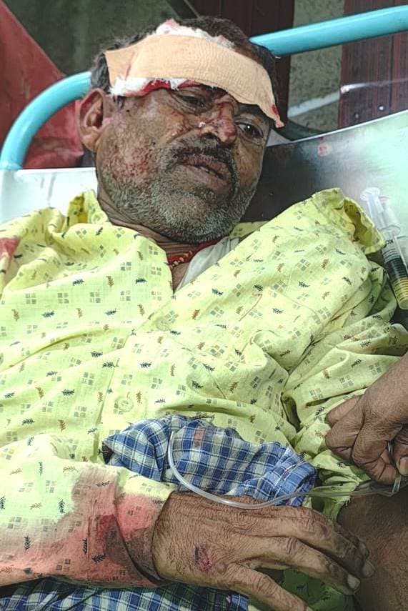 Bhagalpur News: सुलतानगंज में कार की टक्कर से ऑटो सवार आधा दर्जन जख्मी, तीन रेफर