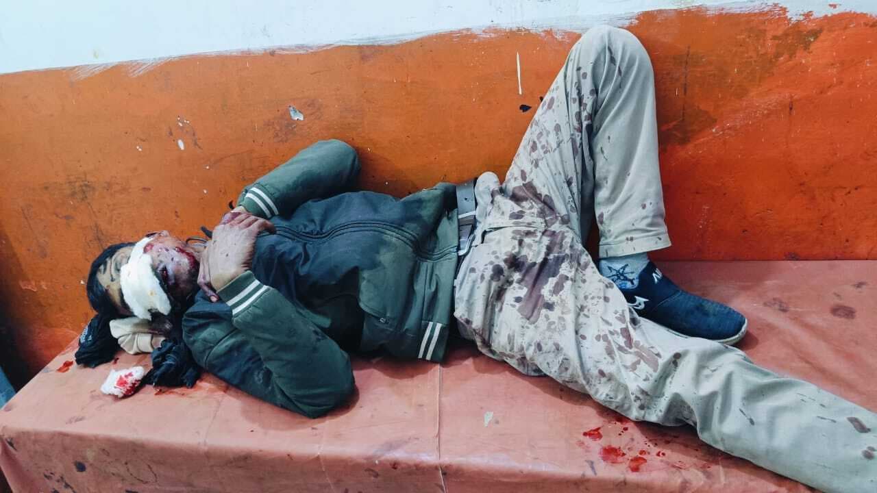 अपराधियों ने चालक के साथ की मारपीट, बाइक लेकर हुये फरार