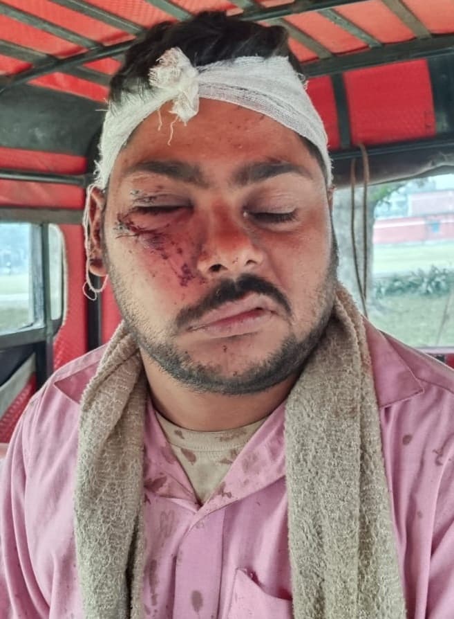 Katihar news : दो पक्षों में खूनी झड़प, आधा दर्जन लोग गंभीर रूप से जख्मी