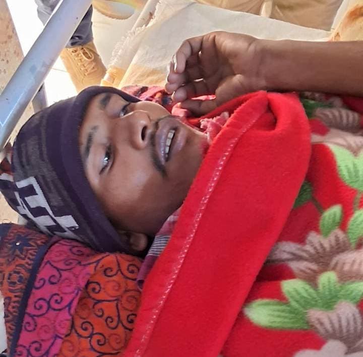 पत्नी से विवाद होने पर पति ने खुद को लगायी आग, सदर अस्पताल में चल रहा इलाज