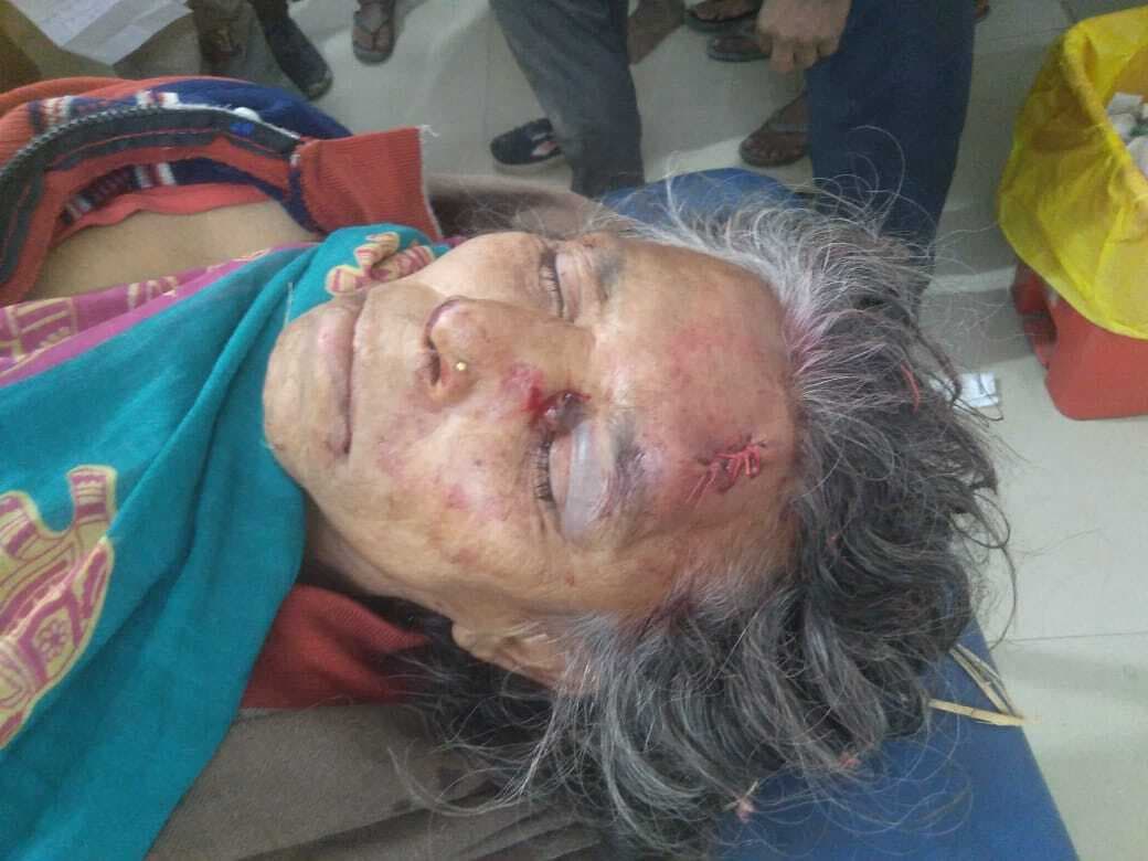 Katihar news : बाइक की ठोकर से वृद्ध महिला व बाइक सवार जख्मी