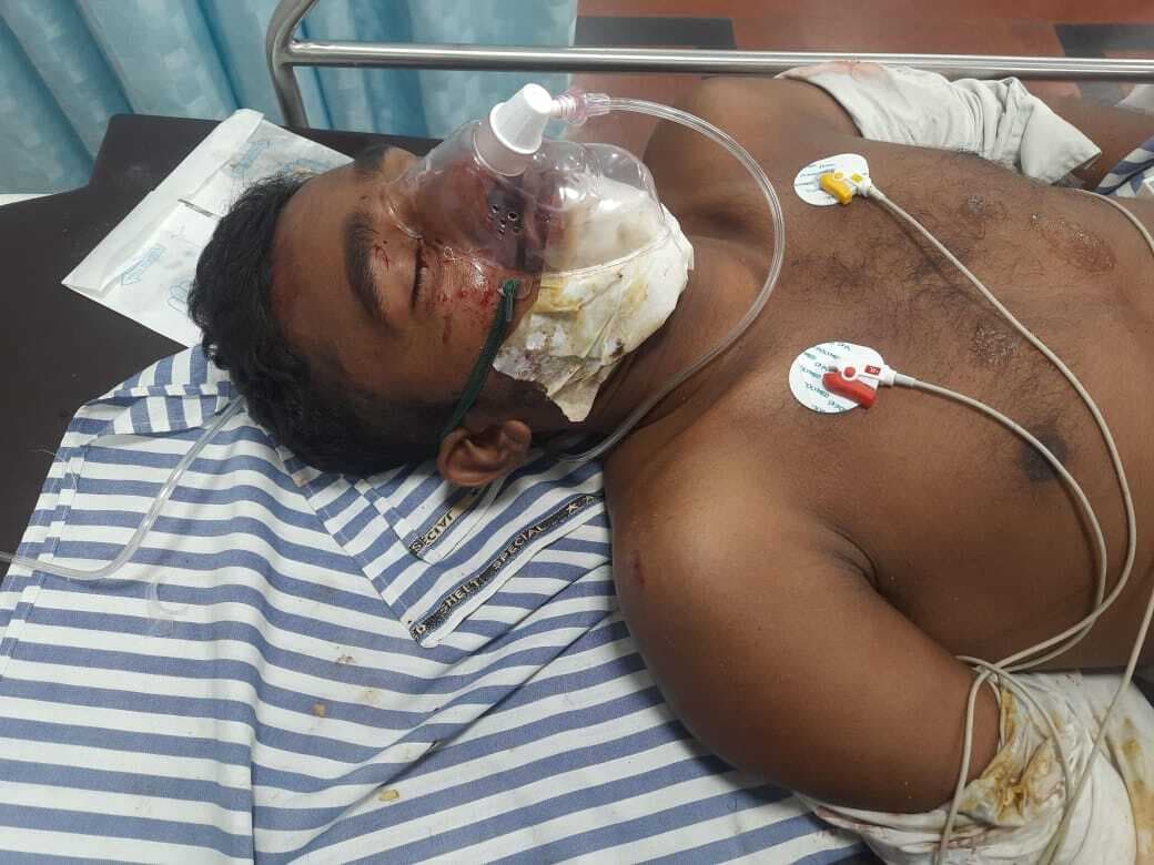 Dhanbad News: भूली में ट्रैक्टर व कार में टक्कर, दो घायल