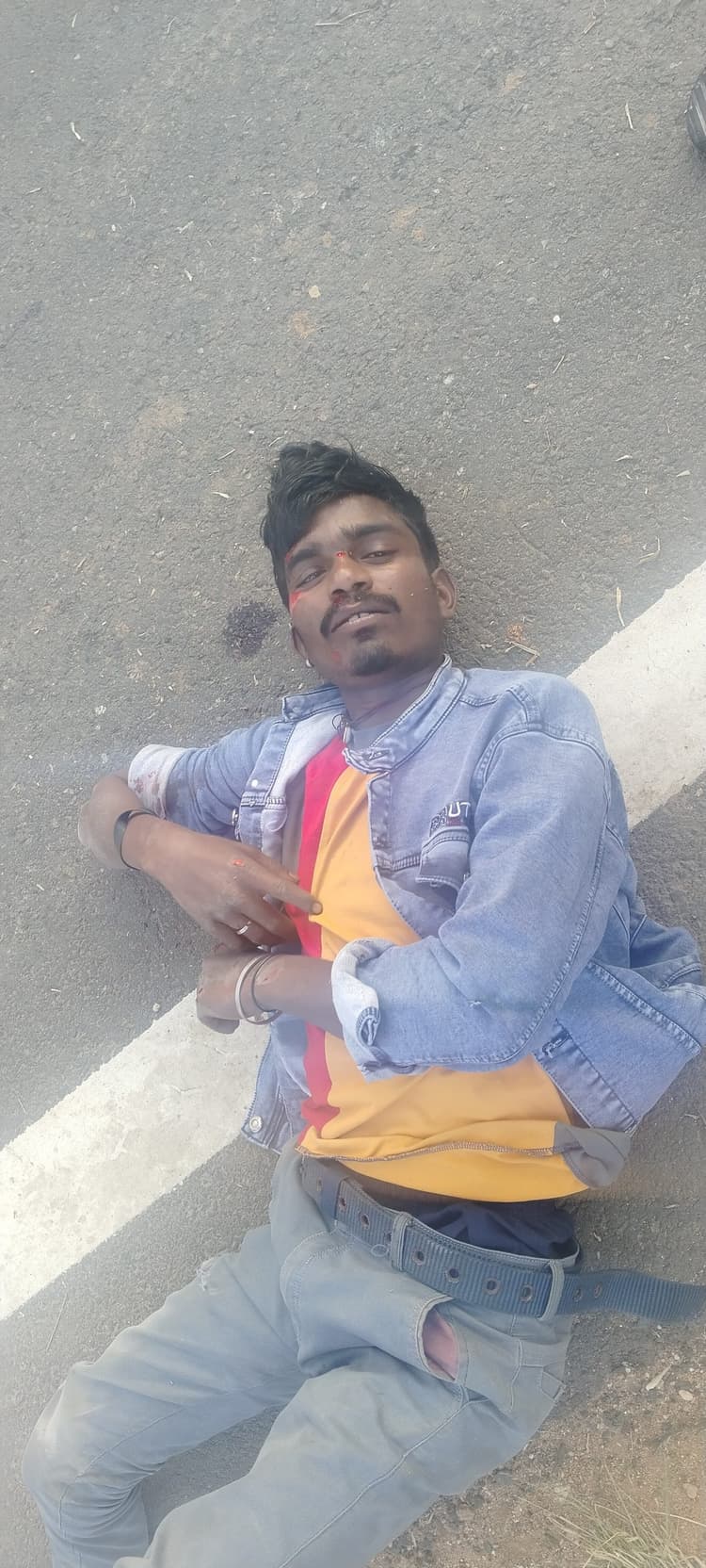 दो बाइकों की हुई टक्कर, एक युवक घायल