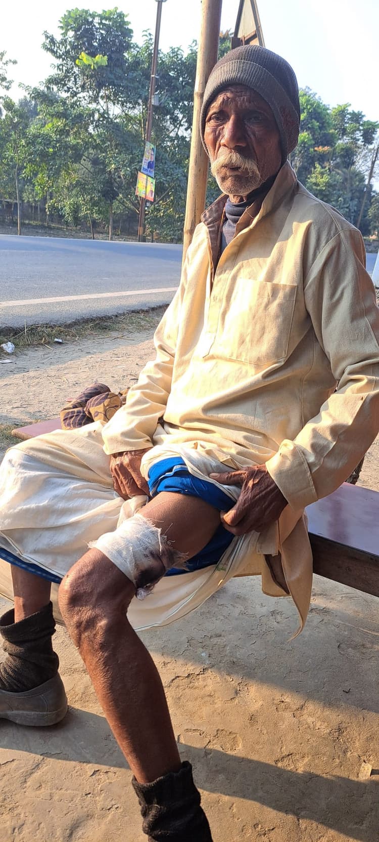 जंगली सुअर के हमले से पांच लोग जख्मी, लोगों में भय का माहौल