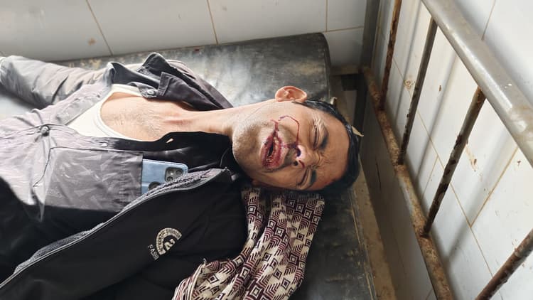 बाइक दुर्घटना में दो युवक गंभीर रूप से घायल