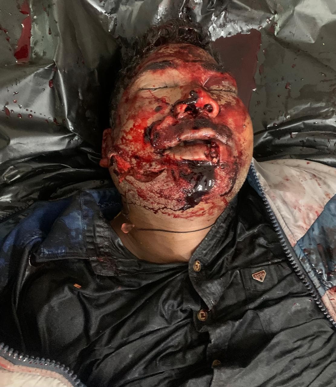 Chaibasa News : मनोहरपुर में वाहन के धक्के से बाइक सवार युवक की मौत, साथी गंभीर