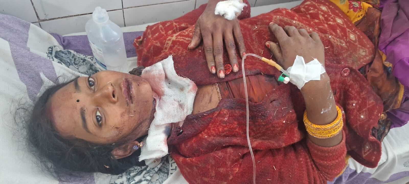 एसकेएमसीएच : गला कटे महिला का तीन घंटे बाद शुरू हुआ इलाज