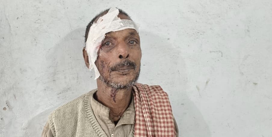 पुत्र के हमले से पिता जख्मी, अस्पताल में भर्ती