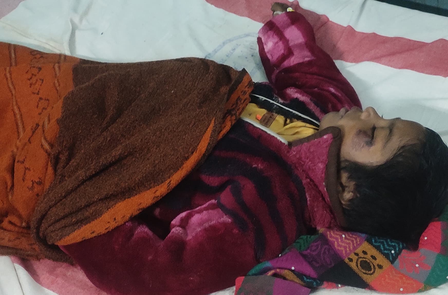 थ्रेसर की ठोकर से बच्चा गंभीर रूप से घायल, रेफर