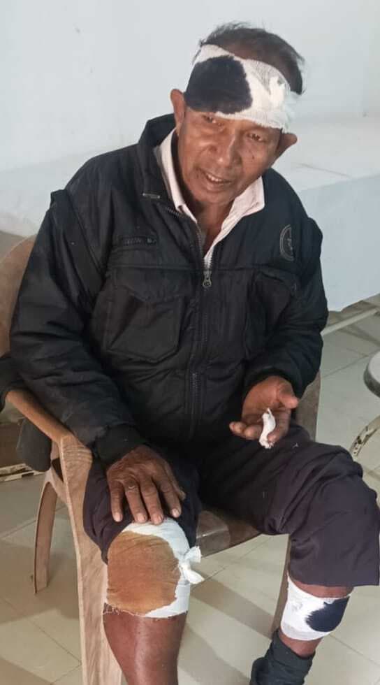 East Singhbhum : कार की चपेट में आने से घाटशिला के बाइक सवार दंपती घायल