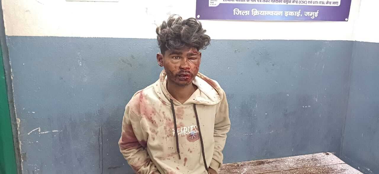 सड़क दुर्घटना में घायल युवक ने एंबुलेंस से कूदकर भागने का किया प्रयास