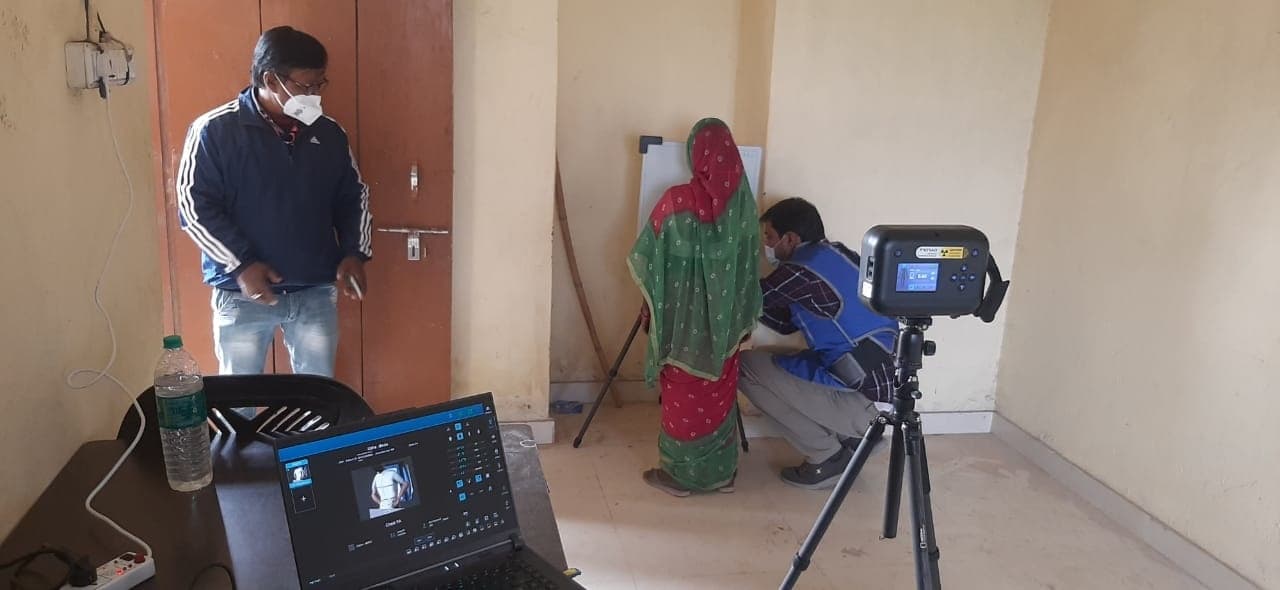 टीबी मुक्त भारत अभियान के तहत जिले को मिला दो पोर्टेबल एक्स-रे