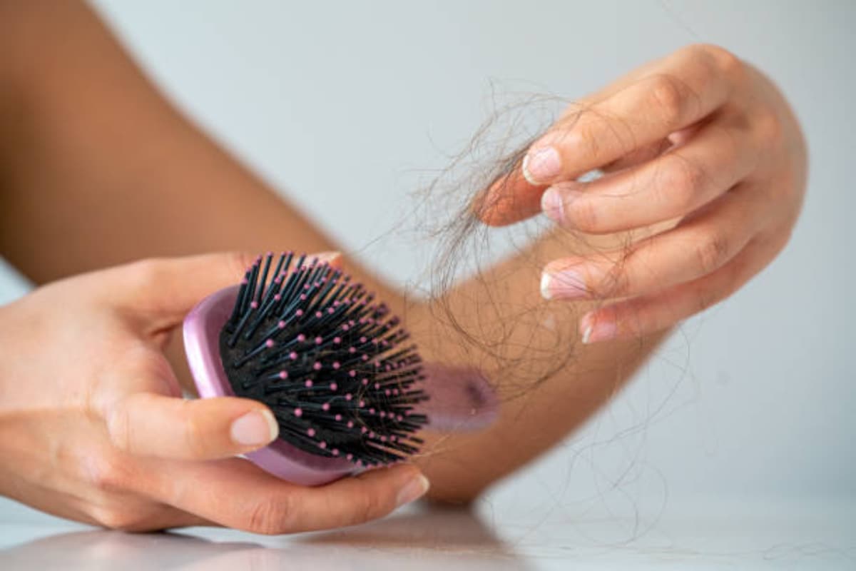 Hair Care Tips: शरीर में इन विटामिन्स की होगी कमी तो झड़ते रहेंगे बाल, जानें बचाव के तरीके
