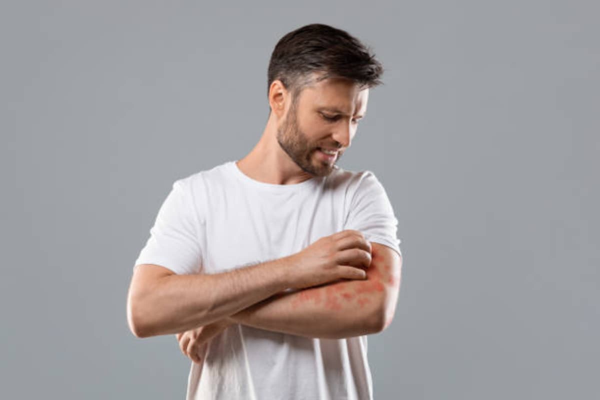 Skincare Tips: सर्दियों में क्यों त्वचा पर आते हैं लाल दाने और होती है खुजली? जानें कारण और बचाव के तरीके
