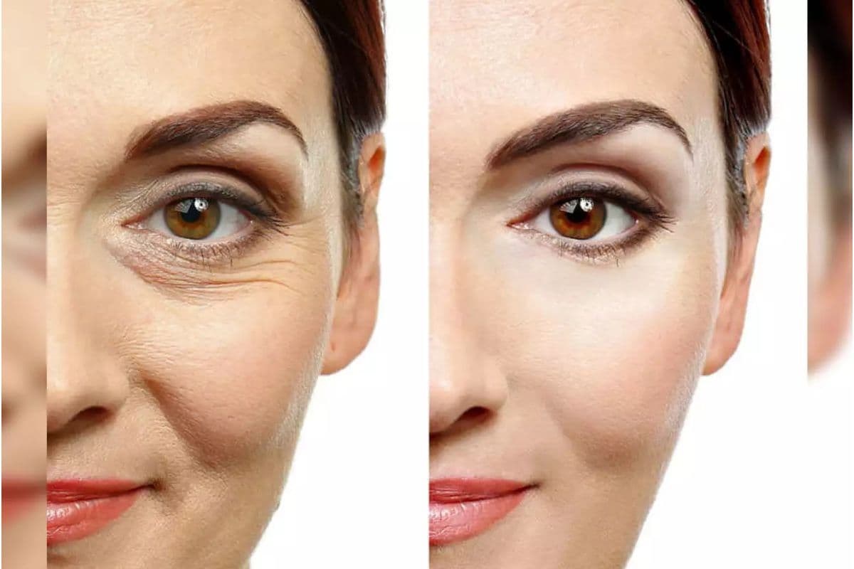 Wrinkles: झुर्रियों को अब कहें अलविदा, इन सुपरफूड्स से बढ़ती उम्र में भी दिखें जवां
