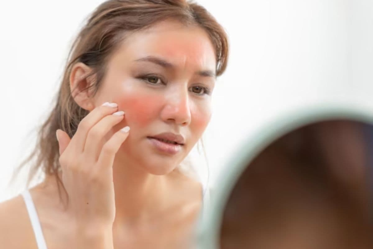 Skincare Tips: सेंसेटिव स्किन से हैं परेशान, तो फॉलो करें ये बेस्ट स्किन केयर टिप्स
