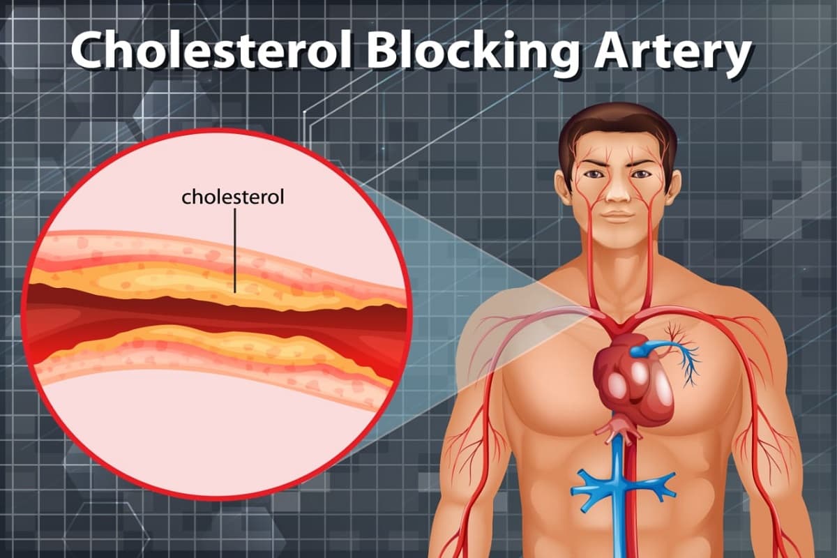 Health Tips:- आपके शरीर से बैड कोलेस्ट्रॉल हो जाएगा गायब ,आज से शुरू करें इन चीजों का सेवन