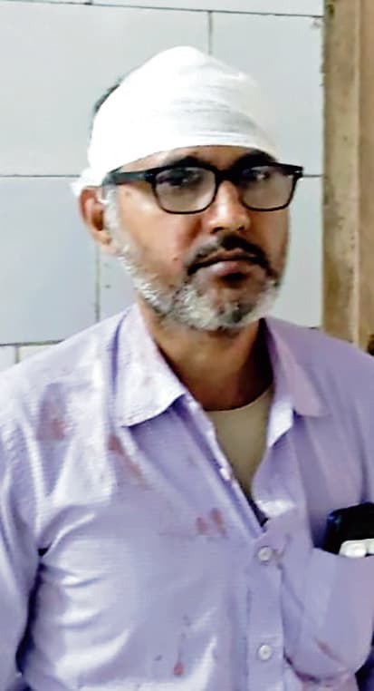 Jamshedpur News : टेल्को में आपसी विवाद में पड़ोसी ने दंपती को पीटा, जख्मी