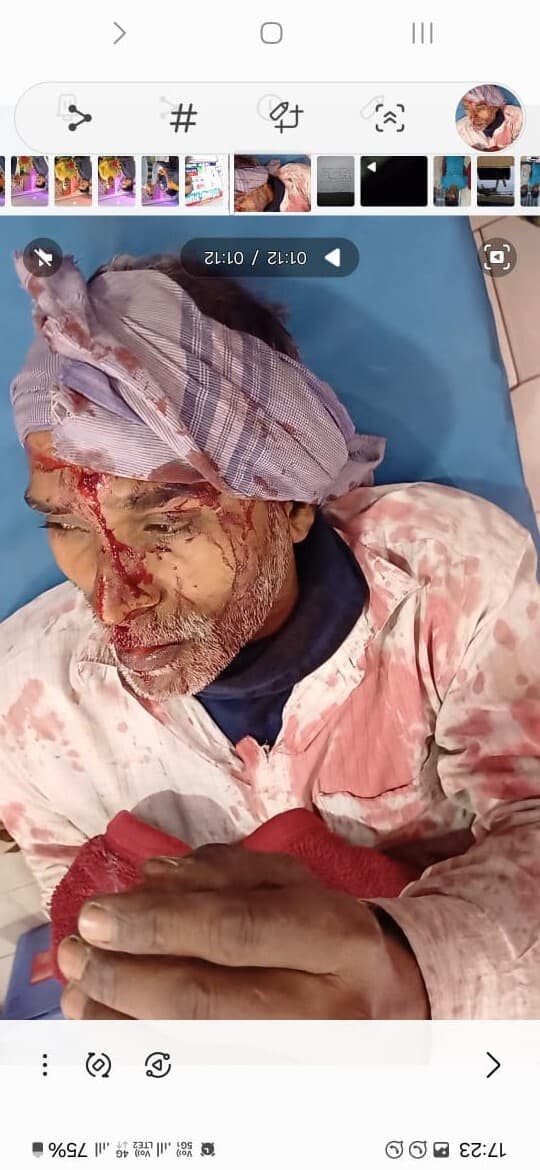 Bhagalpur news दो पक्षों में गोलीबारी, एक जख्मी, कट्टा व गोली के साथ तीन धराये