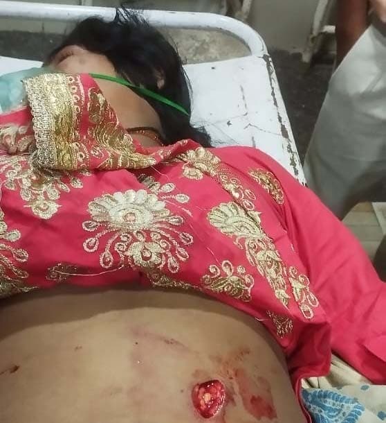 प्रेमिका को चाकू मारकर प्रेमी लाया मेडिकल दुकान, फिर हुआ मौके से फरार