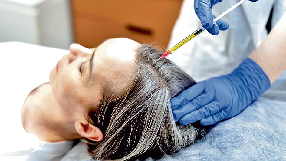 आपका ब्लड दिला सकता है गंजेपन से छुटकारा