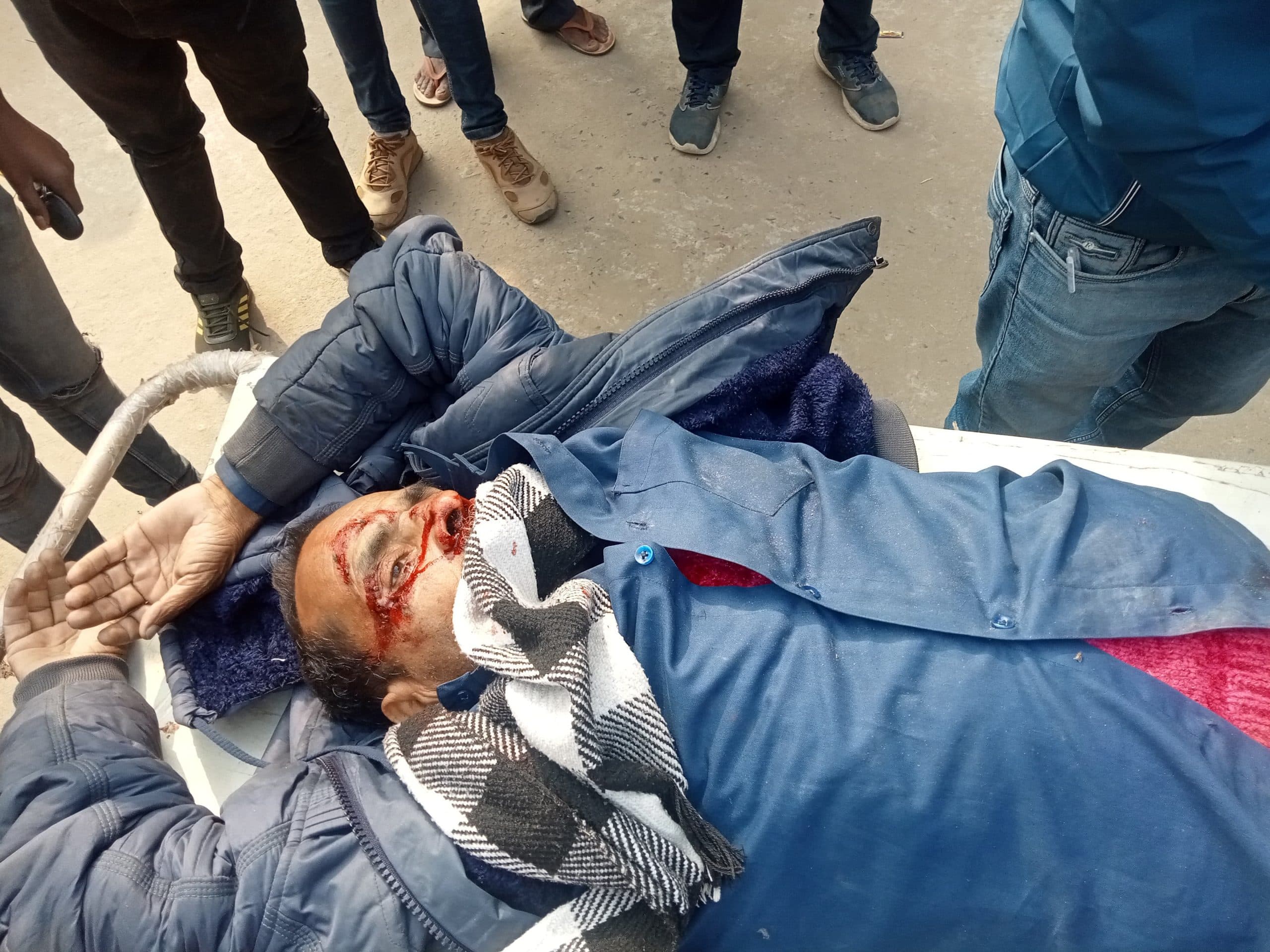 हाइवा ट्रक ने साइकिल सवार को ठोकर, जख्मी