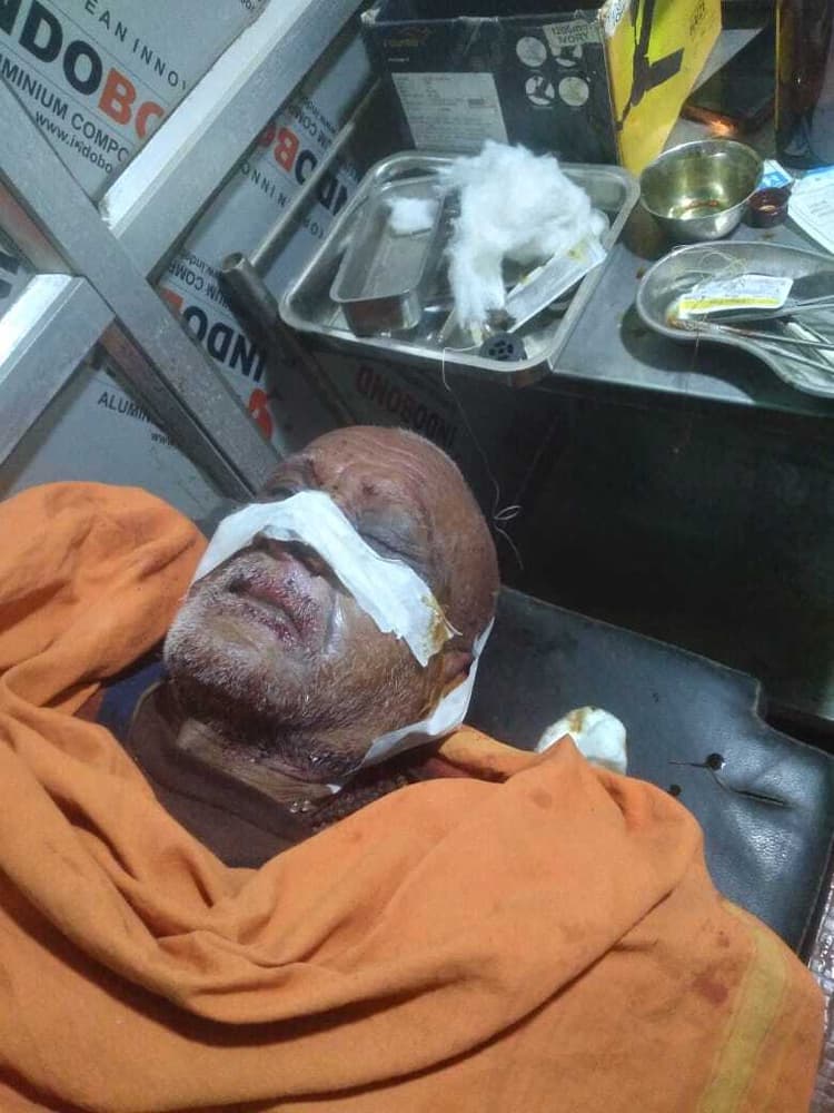 झारखंडी ठाकुरवाड़ी के महंत पर अपराधियों ने धारदार हथियार से किया हमला, घायल