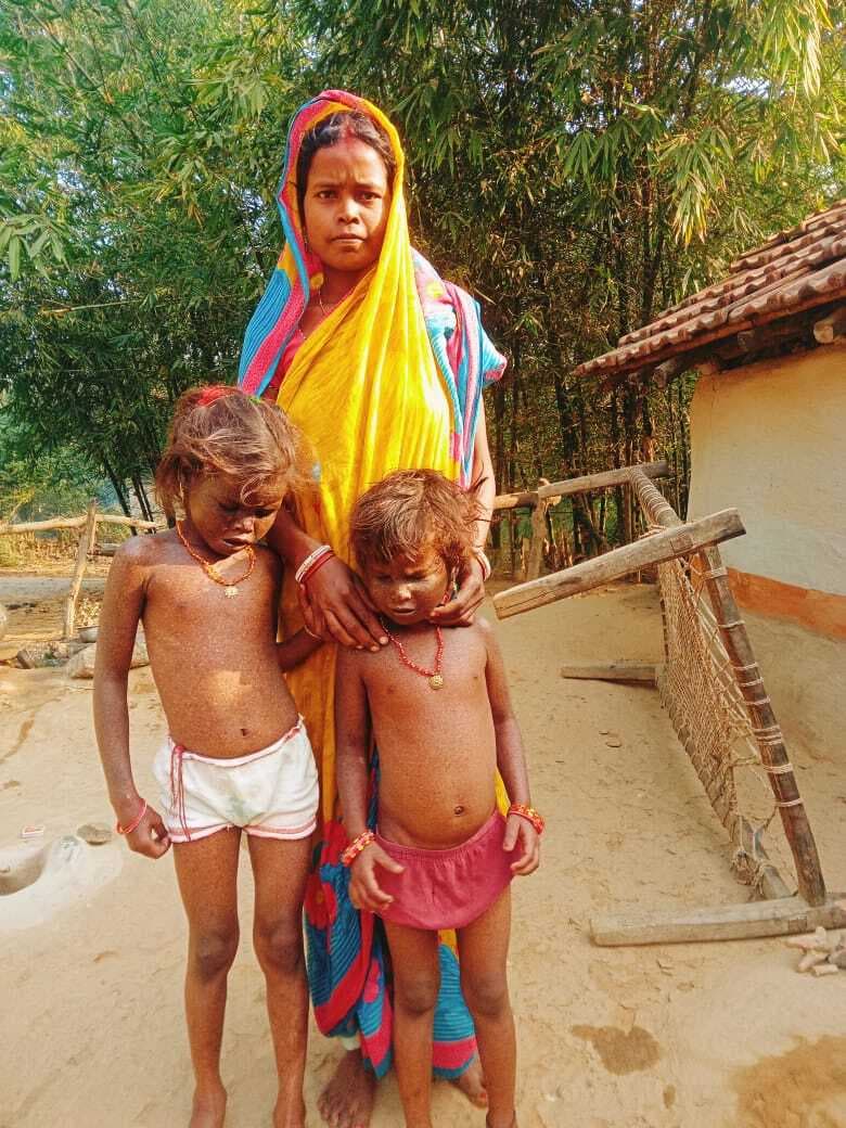 East Singhbhum news : धातकीडीह की दो सबर बच्चियां अज्ञात बीमारी से पीड़ित, इलाज में गरीबी बाधक