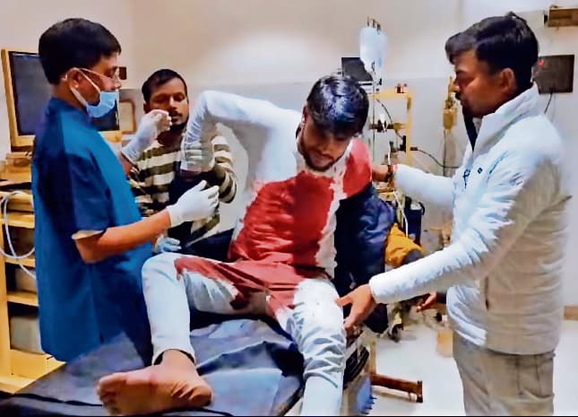 बाइक सवार हथियारबंद बदमाशों ने क्रिकेट खेल रहे ठेकेदार पुत्र को मारी गोली, गंभीर