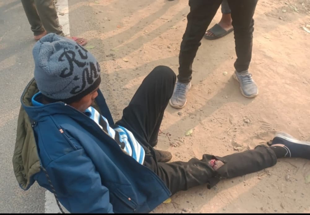 सड़क दुर्घटना में बाइक सवार घायल