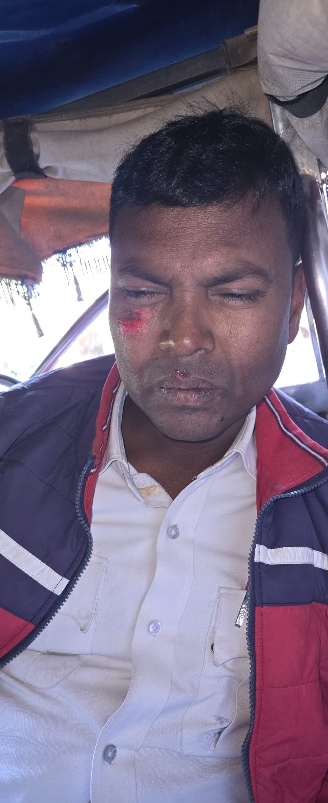 Deoghar News : चेकिंग में बिना हेलमेट वाले बाइक चालन ने यातायात जवान को मारा धक्का, पैर टूटा