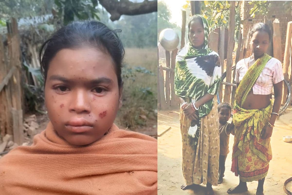 झारखंड के सारंडा जंगल में आईईडी विस्फोट, सात साल की बच्ची की मौत, एक महिला घायल