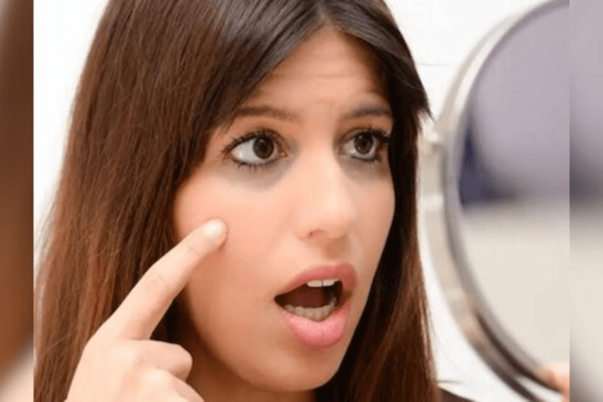 Eye Care home remedies