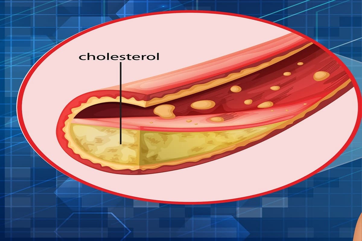 Myths About Cholesterol: क्या कोलेस्ट्रॉल सिर्फ नुकसान पहुंचाता है?, कोलेस्ट्रॉल से जुड़े ऐसे मिथक जिनसे आप अंजान हैं
