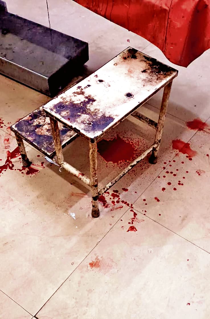 Dhanbad News : इमरजेंसी की माइनर ओटी में खून के धब्बे, संक्रमण के खतरे के बीच होता है मरीजों का इलाज