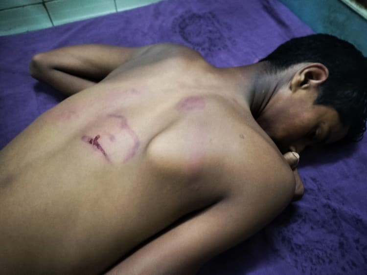 मारपीट कर युवक को किया जख्मी