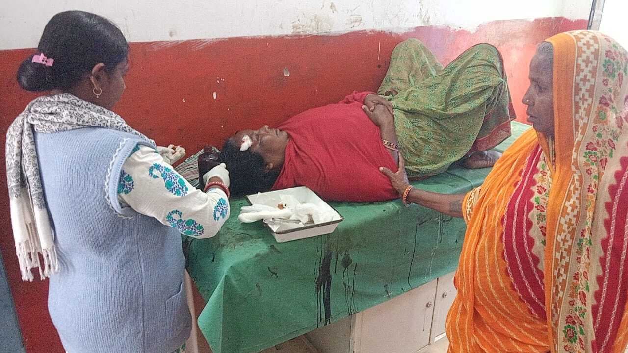 आपसी विवाद में मारपीट, महिला जख्मी